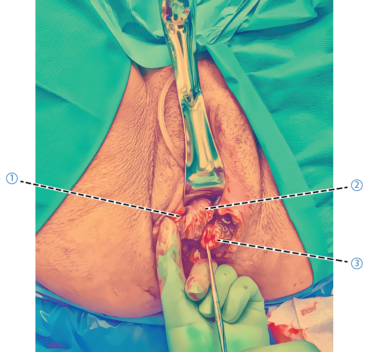 Rekommenderad-underskningsordning