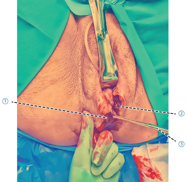Rekommenderad-underskningsordning